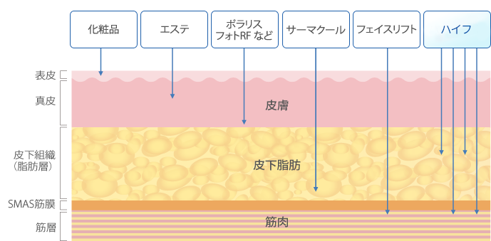 皮膚を支える土台「SMAS筋膜」